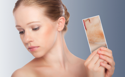 Atopinio dermatito gydymas